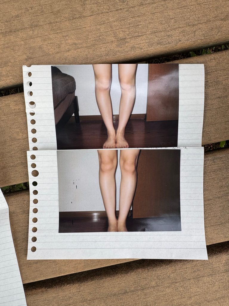 O脚ストレッチの体験談(※個人の感想)ビフォーアフター写真