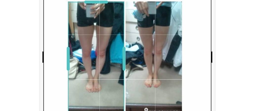 O脚ストレッチの体験談(※個人の感想)ビフォーアフター写真