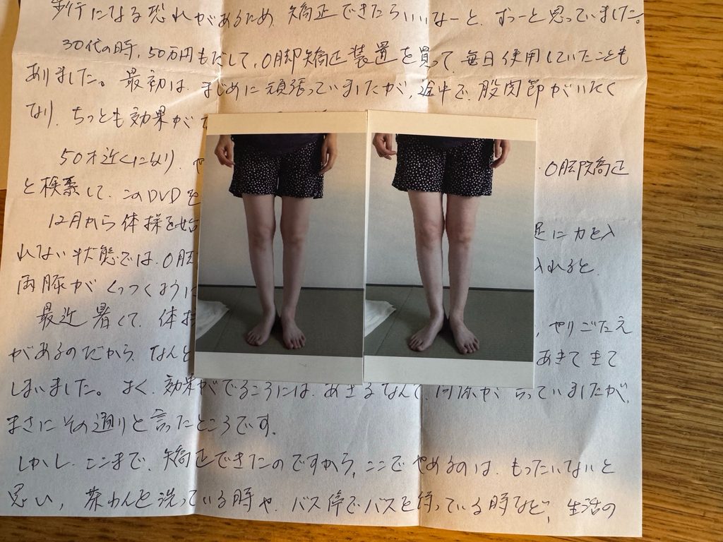 O脚ストレッチの体験談(※個人の感想)ビフォーアフター写真