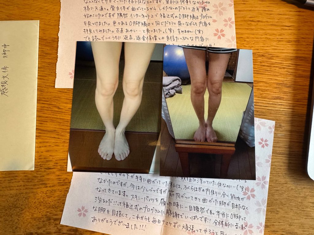 O脚ストレッチの体験談(※個人の感想)ビフォーアフター写真