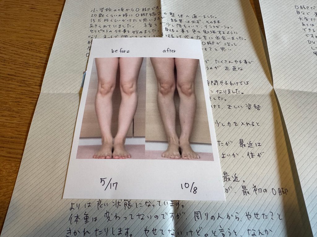 O脚ストレッチの体験談(※個人の感想)ビフォーアフター写真