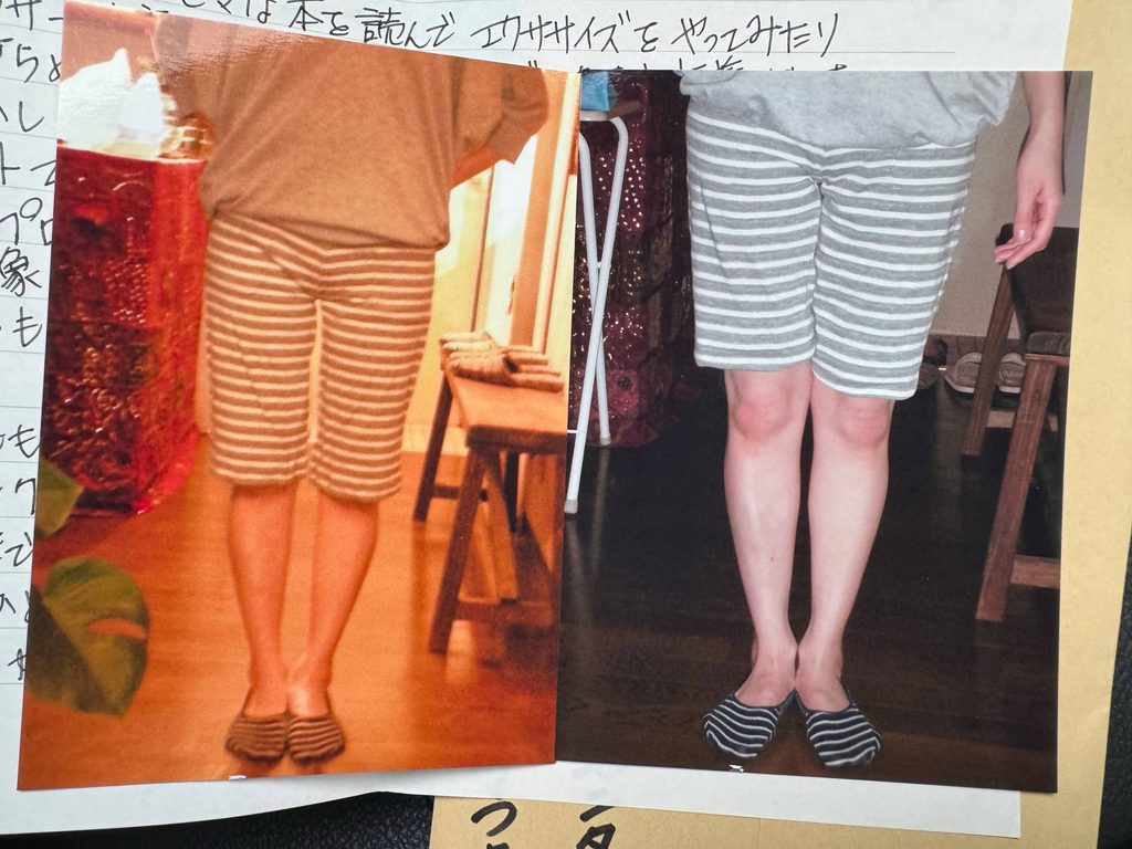 O脚ストレッチの体験談(※個人の感想)ビフォーアフター写真