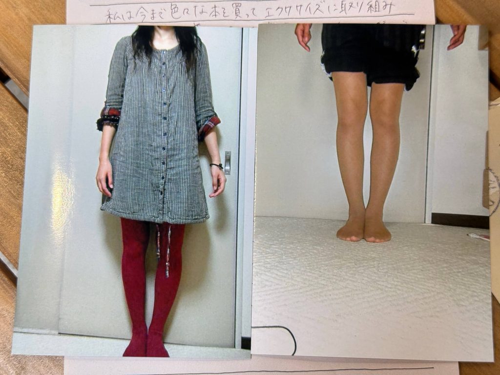 O脚ストレッチの体験談(※個人の感想)ビフォーアフター写真