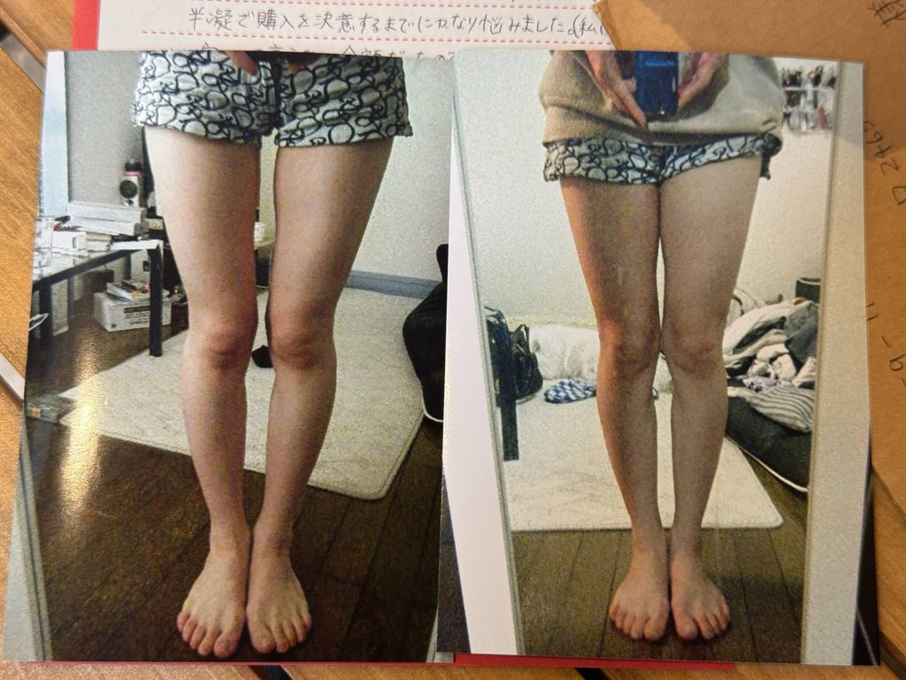 O脚ストレッチの体験談(※個人の感想)ビフォーアフター写真