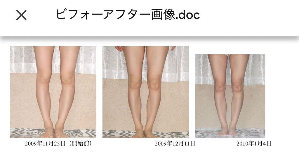 O脚ストレッチの体験談(※個人の感想)ビフォーアフター写真