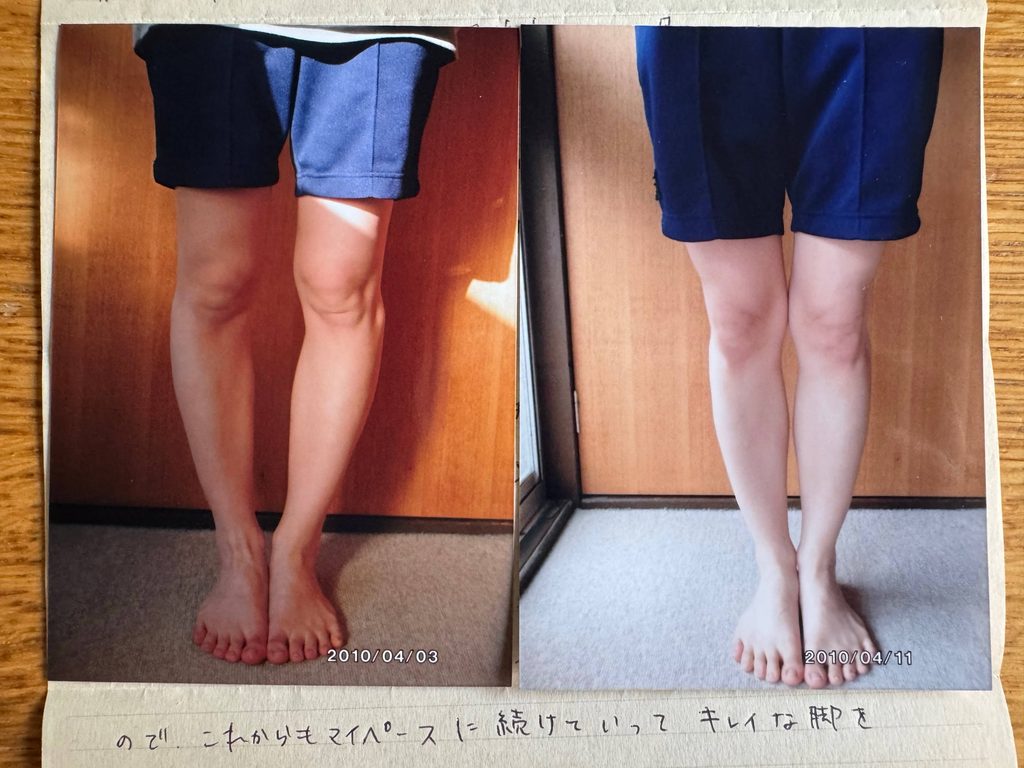 O脚ストレッチの体験談(※個人の感想)ビフォーアフター写真
